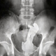 Illustration for article titled Buzz Lightyear Should Not Be Inside Your Ass